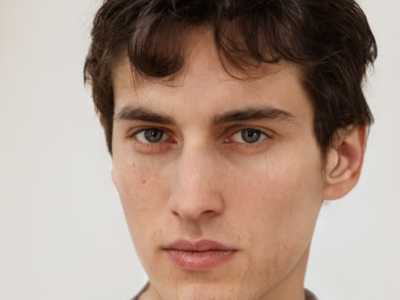 吴红整形医生咋样医生简介_手术风格特色_做鼻孔缩小术案例