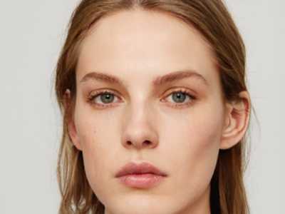 赤峰E光治疗红血丝手术手术费用高不高